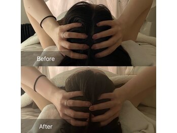 ハートランド(HEARTLAND)/ひたいボトする前に