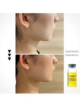 クレア 本店(CREA)/龍ヶ崎初導入！レモンボトル