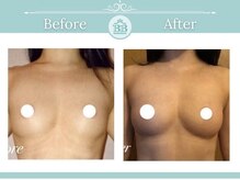 美人バスト 赤羽店の雰囲気(効果◎ふっくら、うっとりバストを叶えます★ バストアップ/育乳)