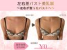 綺麗な形にしたい【左右差】ブラ姿を綺麗に♪バストアップ美乳鍼¥19800→¥0