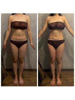 スタイル(Style.)/ビフォーアフター