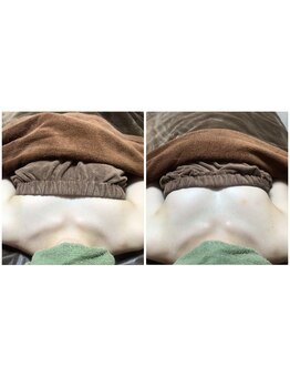 隠れ家エステサロン ミンピ(Mimpi)/バストアップ