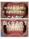 ジンヒ(Jinhi)の写真/専門機関監修ホワイトニングでワンランク上の輝きを★1回の照射でトーンアップを実感◎理想の美しい歯に♪