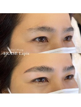 フレイズラピス(FRASE Lapis)/【ハリウッドブロウリフト】