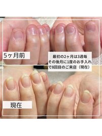 育爪ジェルコース