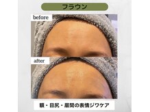 アクティブエイジング/エンビロン/オトナ表情ジワケア