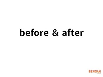 洗顔サロン 池袋(SENGAN)/before&ater