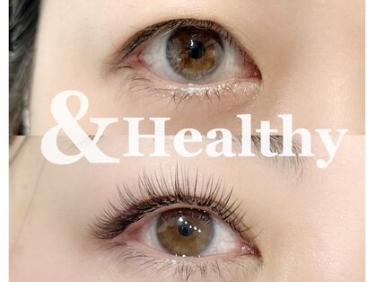 リリー(Lily)の写真