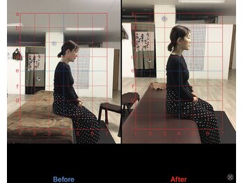 ストレチックス 近江八幡店/BeforeAfter