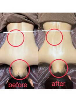 ミラン(MiLaN)/オイルリンパマッサージ骨盤矯正