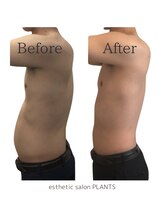 プランツ(PLANTS)/30代／施術回数７回（１ヶ月）