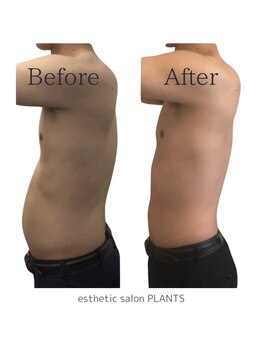 プランツ(PLANTS)/30代／施術回数７回（１ヶ月）