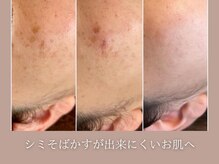 ハクビ(HAKUBI)