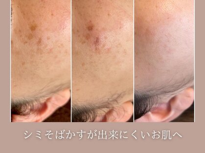 ハクビ(HAKUBI)の写真