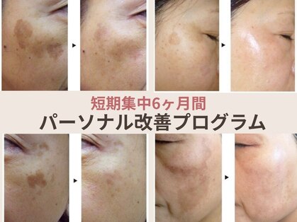 エヴェリーナ(Eveliiina)の写真