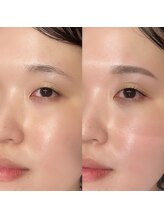 アンジュ 柏店(ANGE)/アイブロウwax【柏駅】