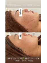 女神のデトックス 仙台店/陶肌トリートメントで艶肌♪