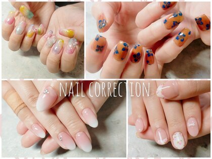 リジュベ(Rejuve)の写真