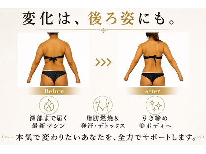 ソエルテ(soerute)の写真