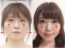 さつま骨格矯正 渋谷 恵比寿本院/歪み小顔矯正