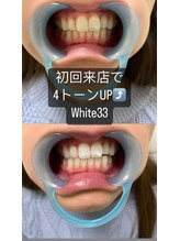 アイブロウ33/ホワイトニング　