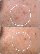 アンド ユー(and.yu)/30代/スポット1回