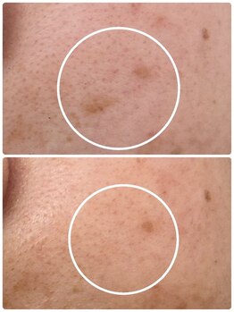 アンド ユー(and.yu)/30代/スポット1回