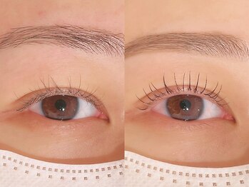 グランアイ 八千代緑が丘店(GRAN EYE)/Before After