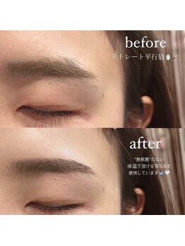 ビオラス 天王寺2号店(Biolus)/【アイブロウ】ビフォーアフター