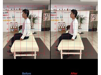 ストレチックス 近江八幡店/BeforeAfter