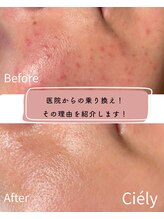 シエリー 原宿本店(Ciely) 肌管理 まめ知識