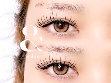 ロコ(Loco)の写真