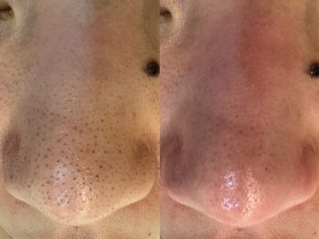 サイセイ(SAISEI)/