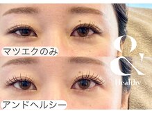 リム(Lim)/マツエク×まつ毛パーマで-10age