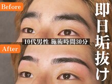 ボス 名古屋店(BOSS)の雰囲気（ヒゲ脱毛/全身脱毛で好印象!#脱毛#メンズ脱毛＃メンズ眉毛サロン）