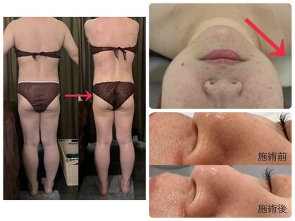 美ネージュの写真