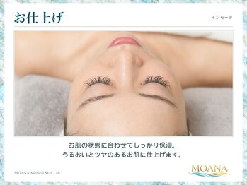モアナ(MOANA)/【小顔/たるみ】インモード