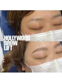 リス 播磨店(Lys)/HBL