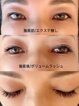 ローズガーデン(ROSE GARDEN)/