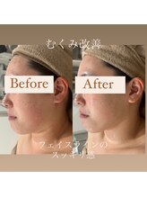 クリニカルホワイトケア 和泉府中店(クリニカルWHITEケア)/むくみ・コリ撃退！！！(1回)