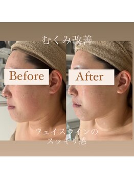 クリニカルホワイトケア 和泉府中店(クリニカルWHITEケア)/むくみ・コリ撃退！！！(1回)