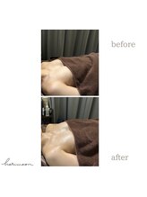 ハリムーン 仙台(harimoon)/ブライダルビフォーアフター