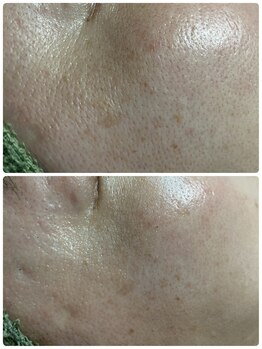 アレーズファイブフォー(A’LAISE54)/艶感UP