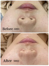 モスト(MOST)/エンビロントリートメント