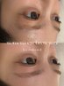 レディース【似合わせ眉毛と産毛ケア】眉毛WAX＋全顔脱毛