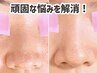 【毛穴改善】毛穴の開き引締め集中ケア！パワー毛穴洗浄+毛穴引締90分¥6,800