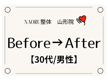 ナオル整体 山形院(NAORU整体)/Before→After【30代/男性】