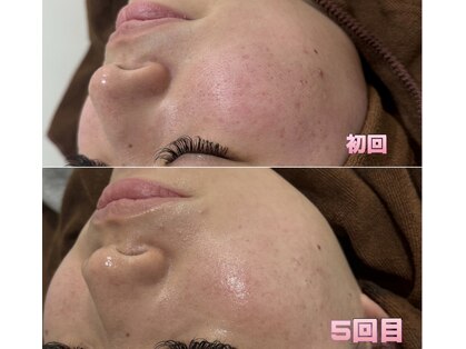 リネ(Rine)の写真