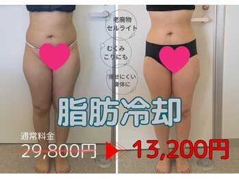 ベル(Belle)の写真/この夏は絶対痩身できれいになる