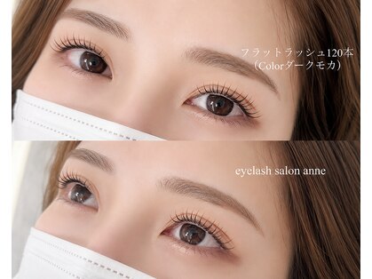 アン(anne)の写真